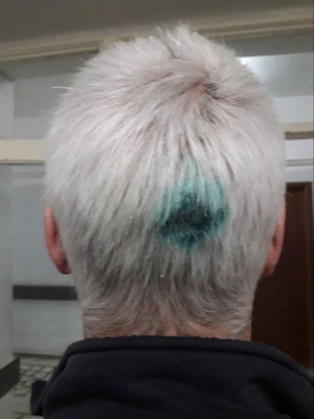 «Кричали, что их отмажут». Челябинца жестоко избили бойцы «Витязя» «Кричали, что их отмажут». Челябинца жестоко избили бойцы «Витязя»