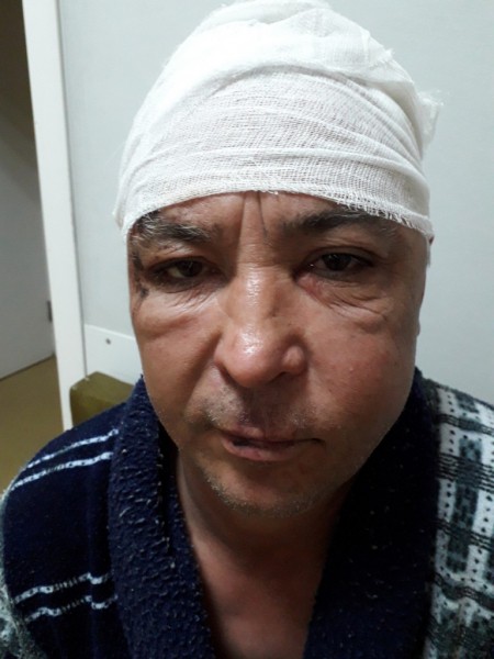 «Кричали, что их отмажут». Челябинца жестоко избили бойцы «Витязя» «Кричали, что их отмажут». Челябинца жестоко избили бойцы «Витязя»