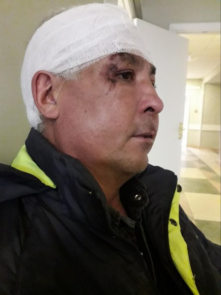 «Кричали, что их отмажут». Челябинца жестоко избили бойцы «Витязя» «Кричали, что их отмажут». Челябинца жестоко избили бойцы «Витязя»