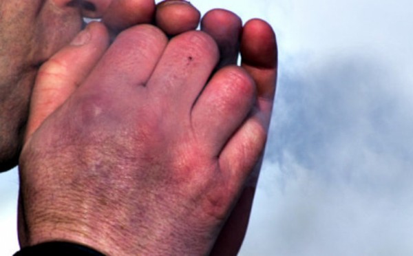 Как защититься в сильные морозы: советы экспертов