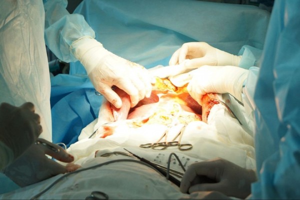 В Челябинске пациенту удалили опухоль в печени с использованием холода В Челябинске пациенту удалили опухоль в печени с использованием холода